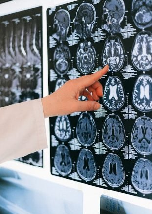 La Inteligencia Artificial transforma el Diagnóstico médico