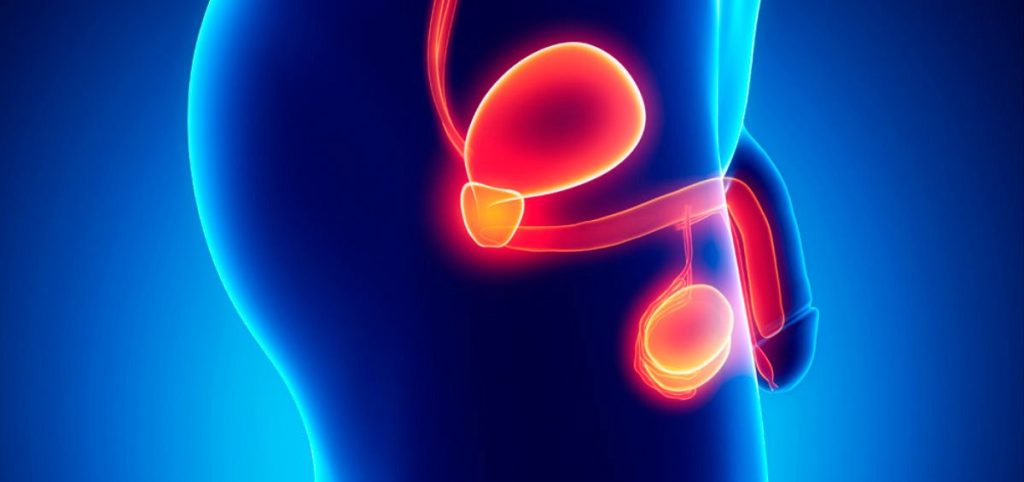 El 60 % de diagnósticos de los cáncer de próstata se hace tarde