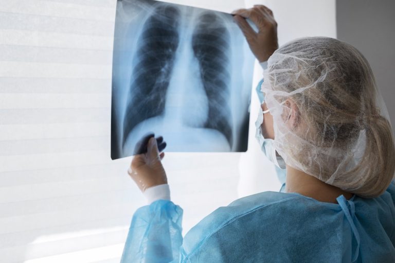 Fibrosis quística y corazón: una relación poco visible, pero importante